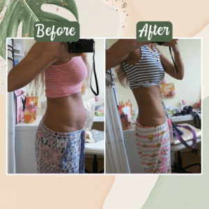 Perfect Detox Slimming Patch(Limited Time Discount 🔥 Last Day) - Emporium Shop
