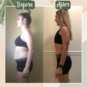 Perfect Detox Slimming Patch(Limited Time Discount 🔥 Last Day) - Emporium Shop