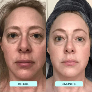 SkynPure™ - Pure Collagen Films - Emporium Shop