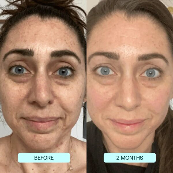 SkynPure™ - Pure Collagen Films - Emporium Shop