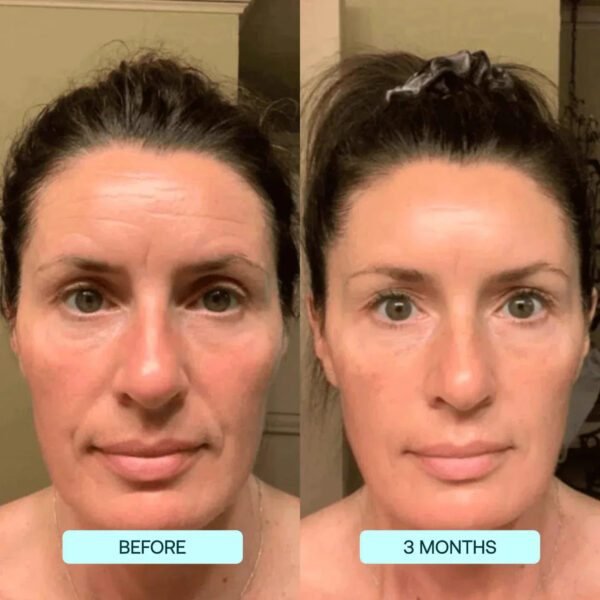 SkynPure™ - Pure Collagen Films - Emporium Shop